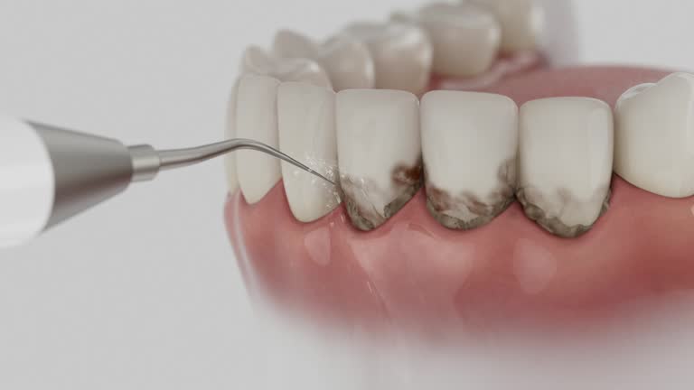 Reliable Dental contractor in Rockville, IN by Dentist Open Now